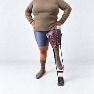 Close clinical photograph of the patient wearing a worn straight-leg calliper constructed with a leather socket, lacing, long metal extensions and a distal footplate.