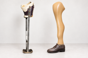 ide-by-side view of two stand-alone assistive devices: a weight-bearing straight-leg calliper with a socket, long metal uprights and distal footplate on the left, and a custom-made, anatomically contoured PFFD Prosthesis wearing a conventional brown lace-up shoe on the right.